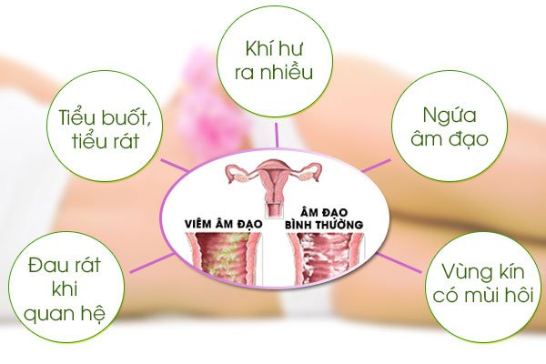 Cách vệ sinh vùng kín đúng cách cho phụ nữ